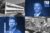 6520 North Andrews Avenue in Fort Lauderdale with Max Cruz of Pinnacle; Bal Harbour Shops at 9700 Collins Avenue in Bal Harbour with Whitman Family Development CEO Matthew Whitman Lazenby (Google Maps, Pinnacle, Whitman Family Development, University of Miami)